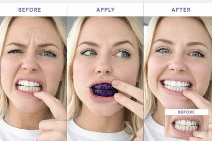 Premium Teeth Whitening Strips | Enamel-Safe Whitening Treatment for Stain Removal & Brighter Smile